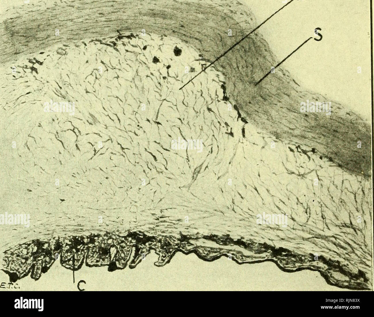 Membrane Bruch Banque d'image et photos Alamy