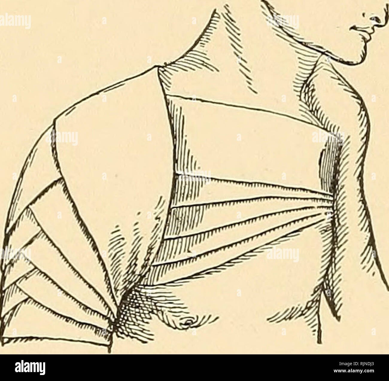 . Bactériologie et chirurgicaux technic pour les infirmières. Les infirmières et les soins infirmiers, les opérations, la chirurgie ; la bactériologie. 74 TECHNIQUE CHIRURGICALE. Continuer jusqu'à ce que les pièces sont couverts (chaque tour sur clapotis- les deux tiers de la précédente). Spica de l'épaule (Croissant) (Fig. 21).-ce bandage est faite par la circulaire tourne autour du bras au niveau de l'aisselle (à fixer). Continuer par une tour oblique en travers de la poitrine de l'autre aisselle, retourner à l'arrière de point de départ. Continuez en re- peating ces tours (ordre croissant par le chevauchement des tours pré- céder les deux tiers).. Veuillez noter que ces images sont extra Banque D'Images