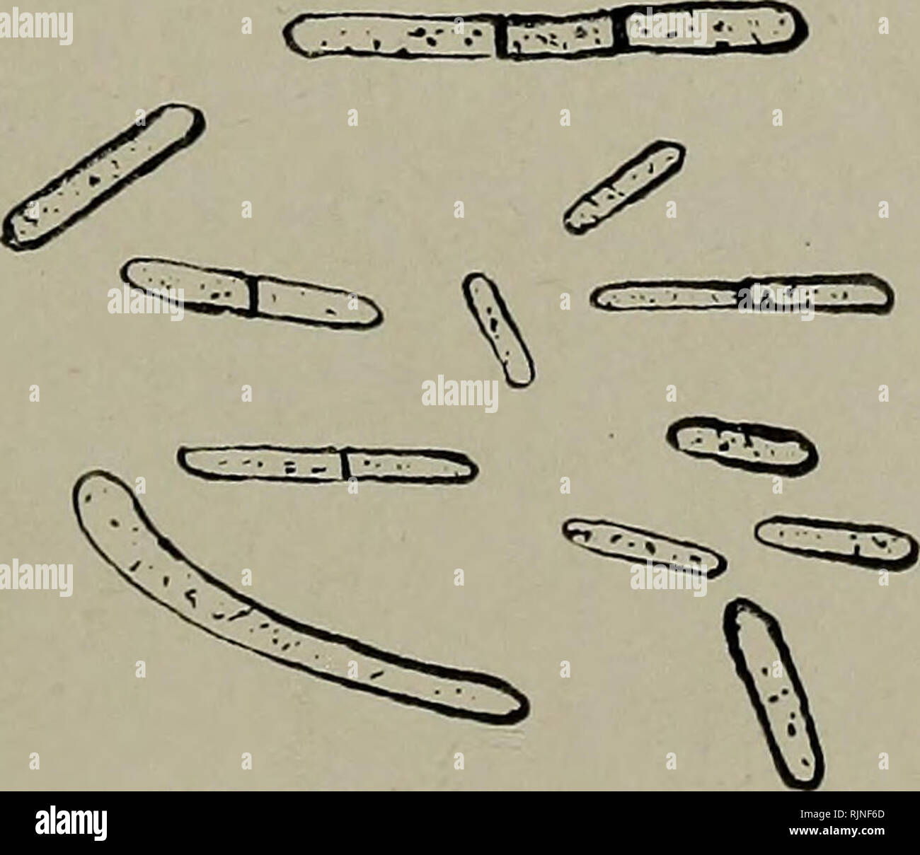 . Les bactéries : d'autant plus qu'elles sont liées à l'économie de la nature, à des procédés industriels et de la santé publique. Bactériologie bactériologie ;. La fermentation des bactéries et organismes 135 (glucides, acides gras, etc.) subissent la decomposi- tion, et par l'oxydation de l'acide carbonique est le gaz, et le reste est laissé comme un " produit " réduit de l'ensemble de pro- cess. D'où parfois, c'est ce qu'on appelle la fermentation par réduction. La formule chimique de cette réaction butyrique peut être exprimée ainsi :- C6H1206 (par décomposition simple)  = 2 C3H603, le glucose. L'acide lactique. qui est suivie par la ferme Banque D'Images