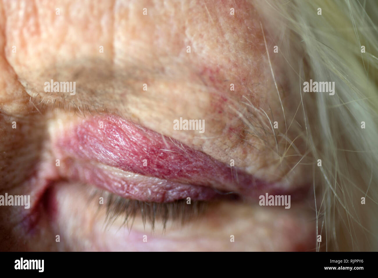 Self Portrait with black eye, 1 février 2019 Banque D'Images