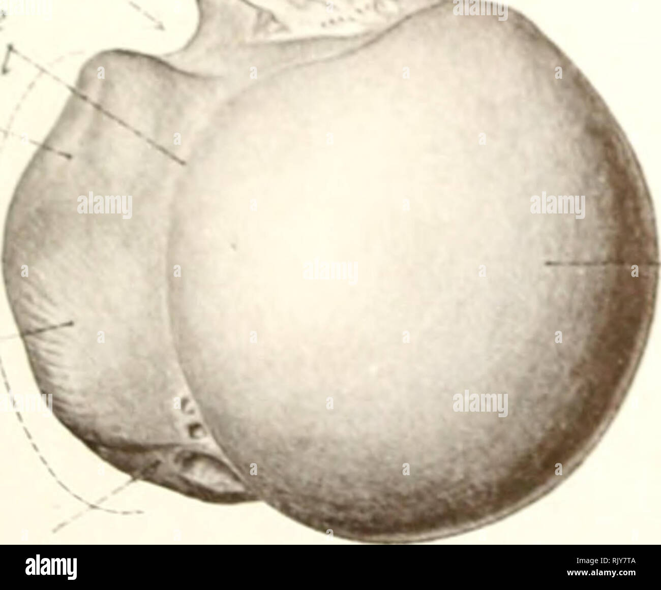 . Texte et Atlas-livre de l'anatomie humaine. Anatomie -- Atlas. Tubercule plus membre supérieur si' j'^ Inlfrtubfratlar Tête Tête Cou anatomique sur groore Chirurgie tubercU alt r cou je fSf} le bacille tuberculeux moindre ridge tuberculeuse de l'arbre de la crête plus Flo. 113. Abaisser extre- mity epicondytc ^ pour rainure externe du nerf radial ^ ^J"Orient face postérieure du foramen frontière interne Antcro-interne fossa fossa , Olrcrnnon Coronoid , cpicondyle tntertuberculc interne interne.rainure r cou anatomique plus^ 1 rainure epicondyle de tubercule ulnaire pour tuberch nene moindre tubercule deltoïde rm Banque D'Images