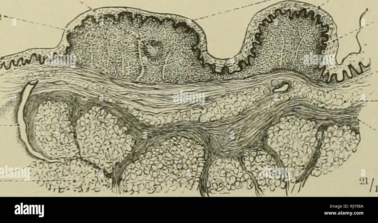 . Un atlas de l'anatomie humaine pour les étudiants et les médecins. L'anatomie. Vallum circulaire de la papille de fosse circulaire / la papille glandes séreuses.^ ^M', J ( serosae^'andula ; fig. 683.-papille papille Vallata, Circumvallate de la langue, en section longitudinale. Follicule lymphoïde lymphe-iticus Nodulus tissu adénoïde couche papillaire de la muqueuse du conduit excréteur d'une glande muqueuse Glandula glandes muqueuses- muqueuses. Lenticulares papilles papilles lenticulaires épithélium stratifié lobules de tissus adipeux tissu aréolaire de la muqueuse (corium) lamina propria mucosae fibreux Submucous stra Banque D'Images