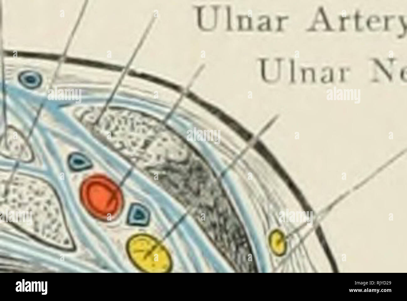 . De l'Atlas topographique (appliquée) L'anatomie humaine pour étudiants et praticiens. L'anatomie. Fli-xor C:irpi Ulnaris Mnsilc fléchisseur profond des doigts ('extenseurs communs de doigts ^^Xj s^S^^. ?- Posterior Interosseous extenseur de nerf de 5ème doigt Ossis extenseur muscle abducteur du pouce Metacarpi Uliiari^ Fig. 90. La section transversale à la jonction de la partie supérieure et du tiers de l'avant-bras (à droite). Nat. La taille. Fléchisseurs superficiel des doigts 3e, 2e, (e, 5e doigts de fléchisseur profond (3ème, 4tli ami s^Palniaris Lougus h) , Muscle 1 i / Elexor Carpi Ulnaris nerf médian muscle fléchisseur radial deuxième MuscU j Banque D'Images