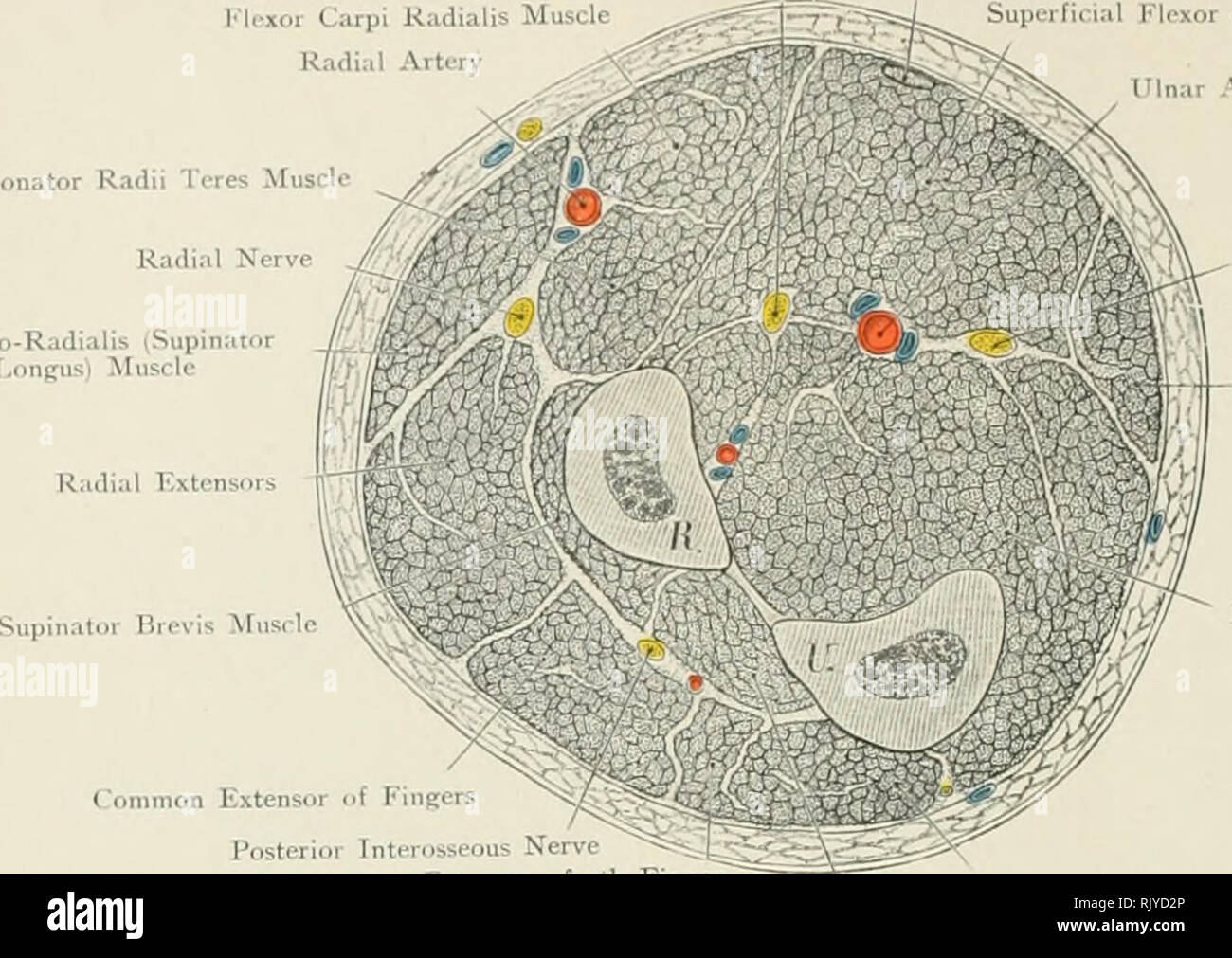 . De l'Atlas topographique (appliquée) L'anatomie humaine pour étudiants et praticiens. L'anatomie. Mcduin Xcrvc^Lon ilmaris r;Miis ws-lt ; Ir l'"l(^xor radial deuxième artère radiale Muscle Pronator Teres Rayons Brachio-Radialis (Supinator Muscle Longus muscle fléchisseur superficiel) de tlio Finpcrs TTlnar l'artère ulnaire nerf. Fli-xor C:irpi Ulnaris Mnsilc fléchisseur profond des doigts ('extenseurs communs de doigts ^^Xj s^S^^. ?- Posterior Interosseous extenseur de nerf de 5ème doigt Ossis extenseur muscle abducteur du pouce Metacarpi Uliiari^ Fig. 90. La section transversale à la jonction de la partie supérieure et du tiers de th Banque D'Images