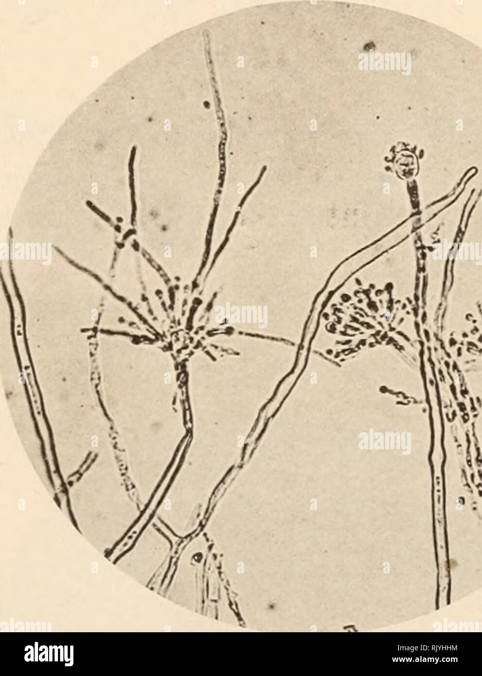 . Atlas de microbiologie ... Roussel, Georges ; microbiologie. MOISISSURES STRUCTURE 25 D'UN STÃRIGMATOCYSTE Le mode d'insertion des stÃ©rigmates primitifs et des stÃ©rigmates secondaires, qui caractÃ©risent le genre StÃ©rigmatocyste, puis le mode d'insertion des spores sur ces derniers, la participation financière de trà sont Ã©vidents sur la figure 27, qui reprÃ©sente au grossissement de 1000 diamÃ¨tres un petit StÃ©rigmatocyste¨d'espÃ non dÃ©terminÃ ce©e. * STERIGMATOCYSTIS GLAUCUS Une des variÃ©tÃ©s les plus curieuses par ses formes de souffrance est le Sterigmatocystis glaucus{Ã"g. 28), qui se dÃ©veloppe en divans duv Banque D'Images