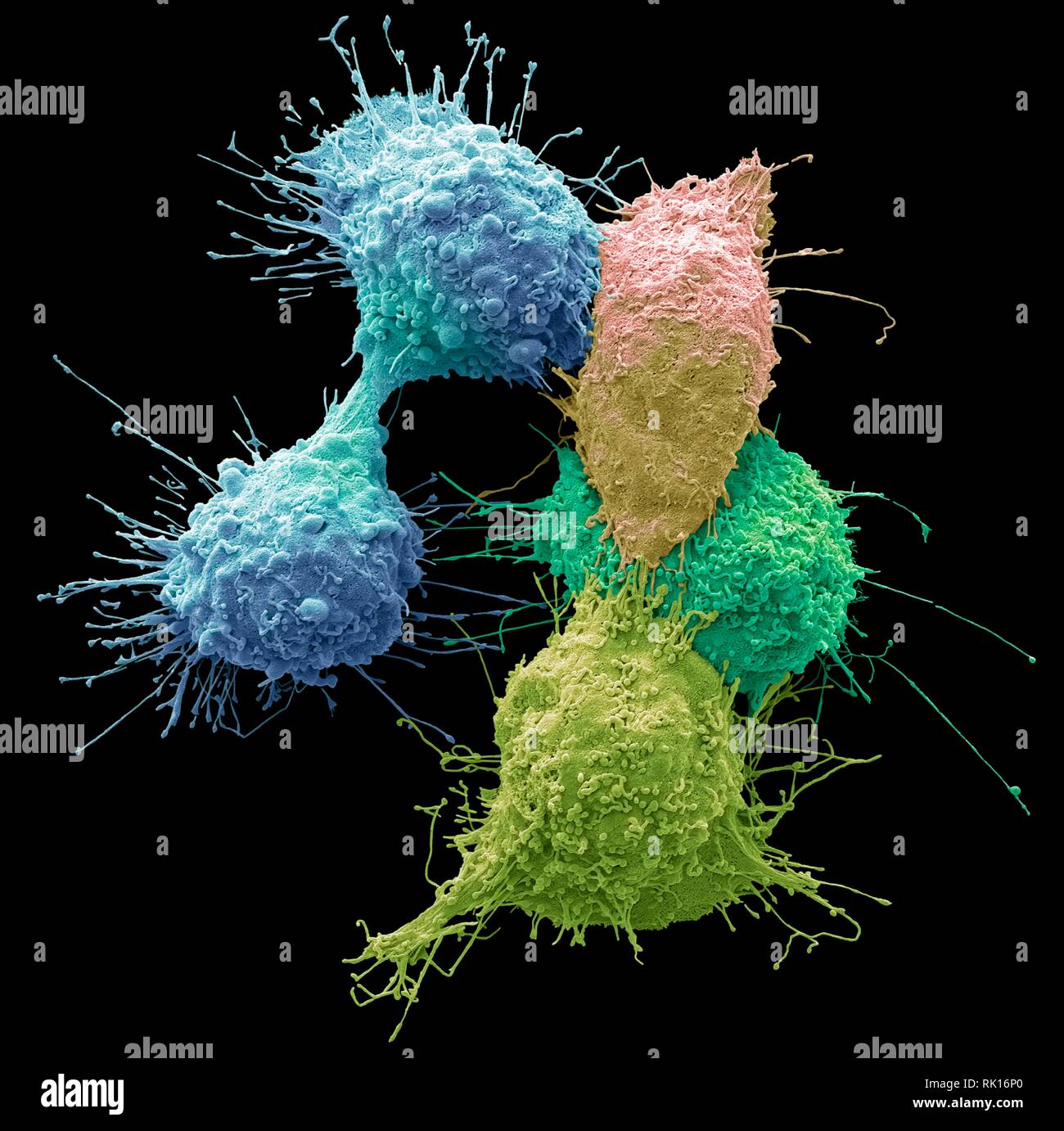 Les cellules du cancer de l'ovaire, SEM Banque D'Images