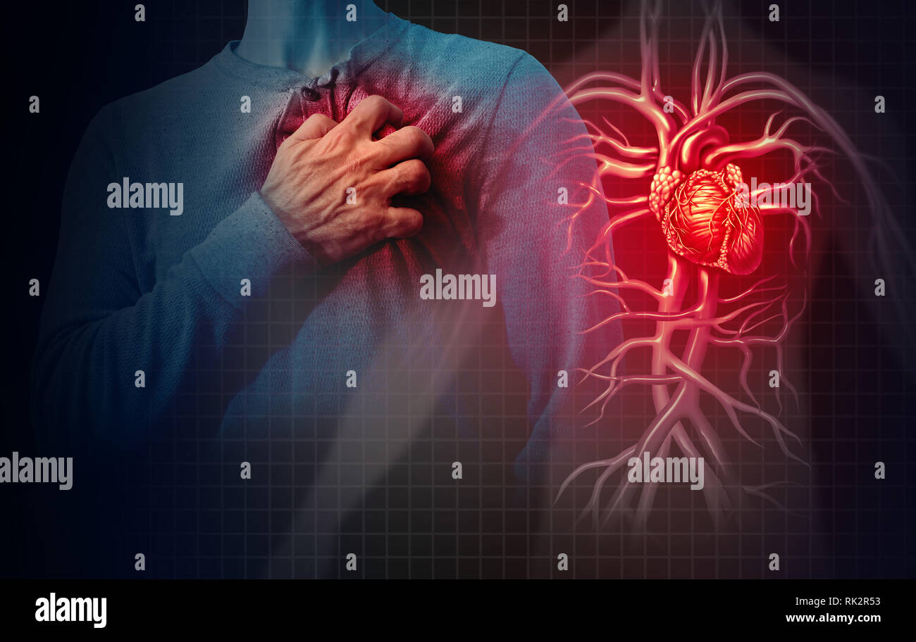 Concept de crise cardiaque et des douleurs cardio-vasculaires comme une anatomie maladie médicale concept avec une personne souffrant d'une maladie cardiaque. Banque D'Images