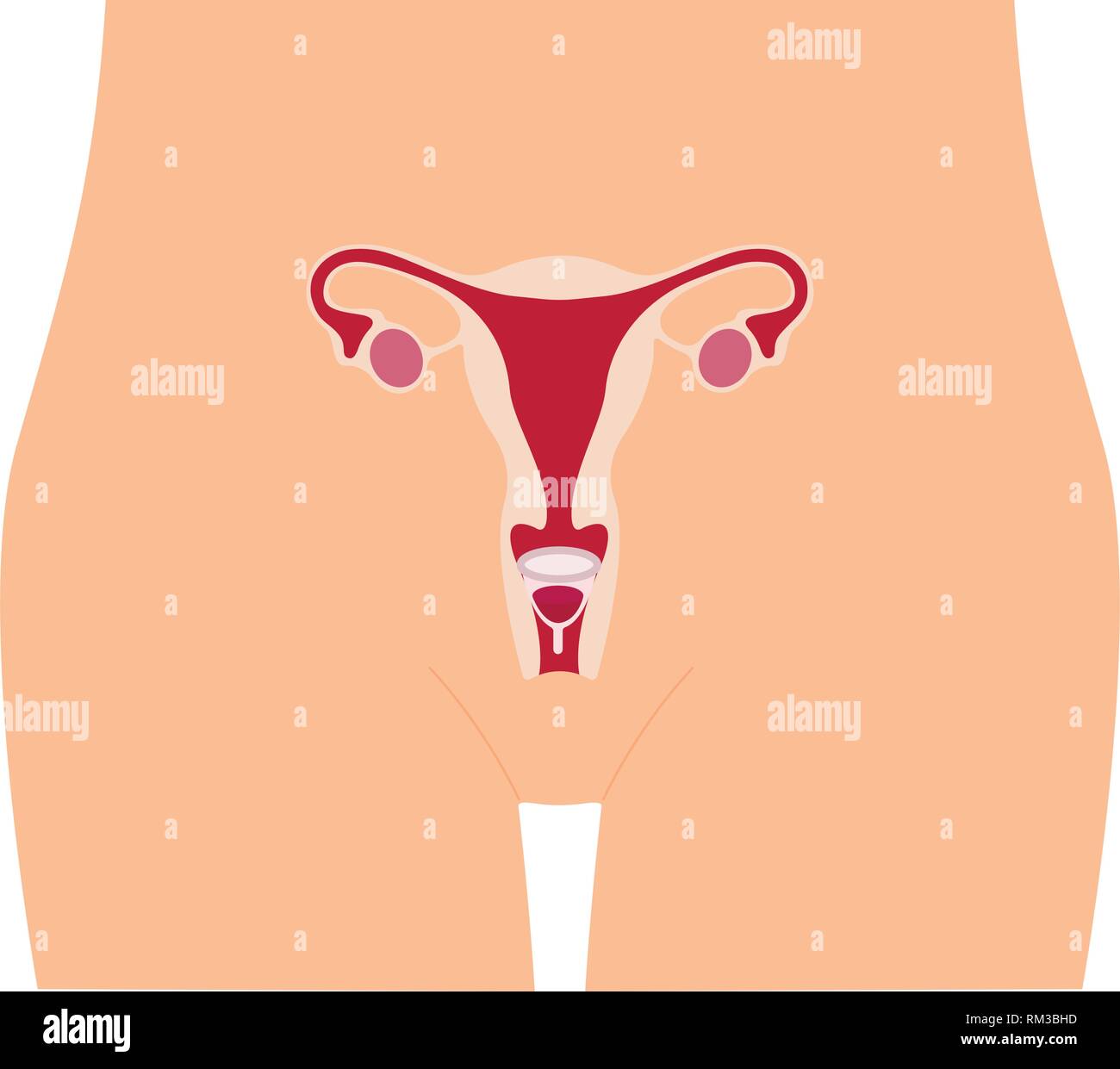 Coupelle menstruelle - produit d'hygiène féminine, l'appareil de collecte de sang au cours de la menstruation et de la période est utilisé à l'intérieur du vagin d'une femme de sexe féminin. Illustration de Vecteur