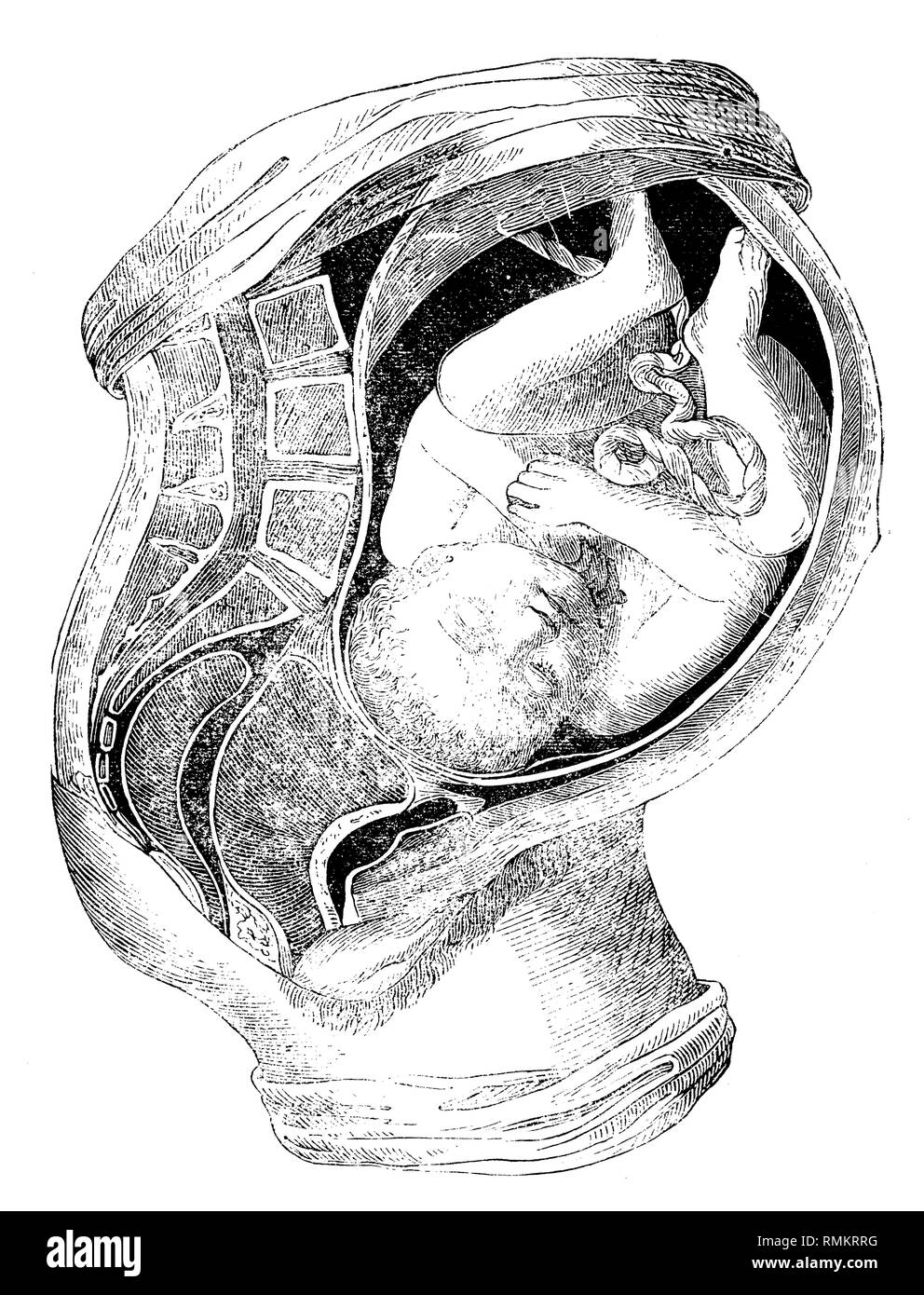 Partie latérale de l'abdomen d'une femme enceinte dans le dixième mois. La position normale de l'enfant, 1900 Banque D'Images