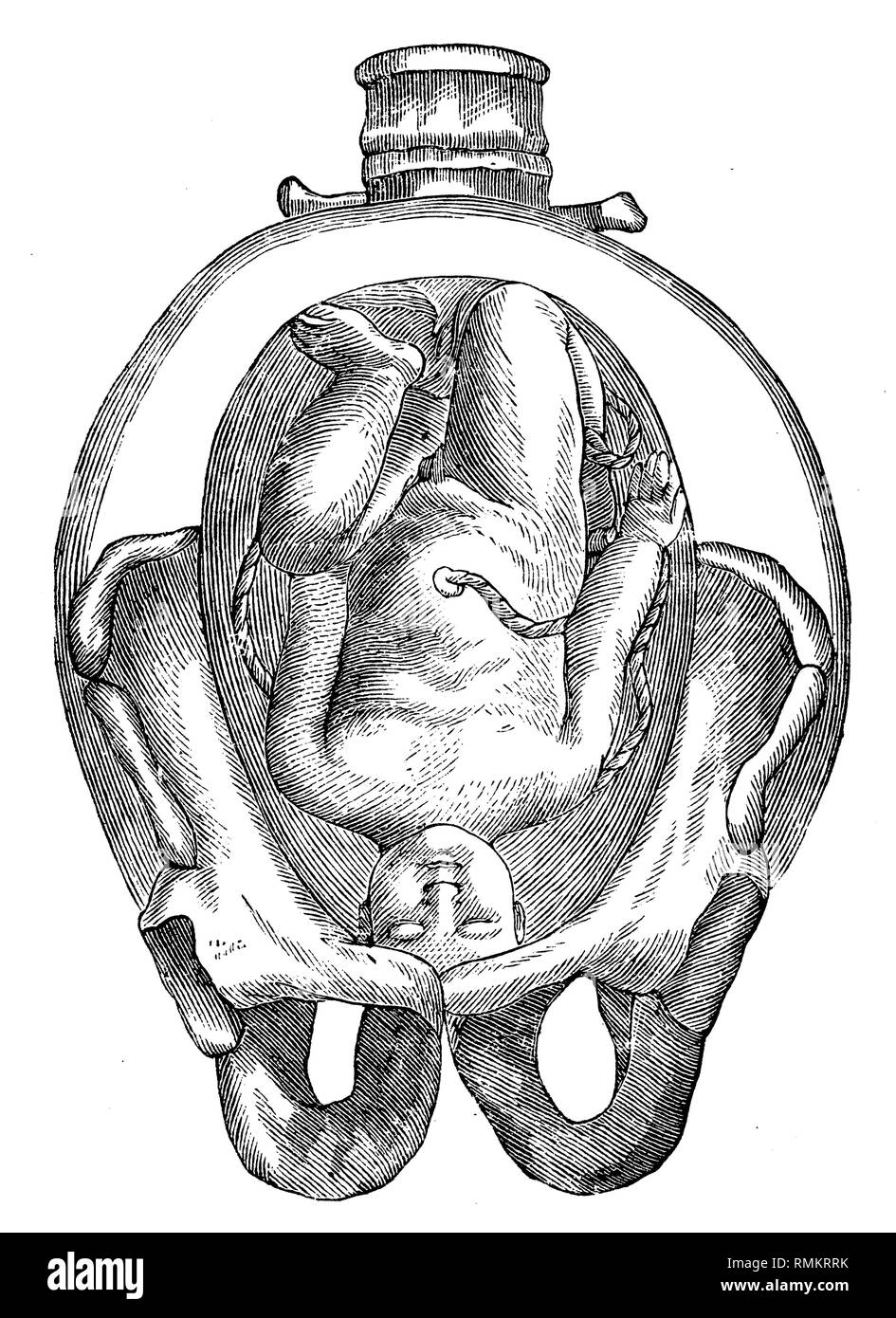 Foetus Dans l'utérus, 1900 Banque D'Images