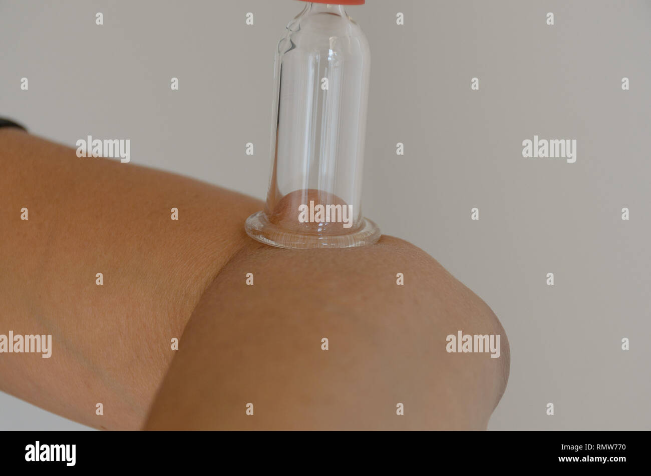 Close up sur le rouge et l'ampoule transparente cupping therapy périphérique relié au coude in front of white background Banque D'Images