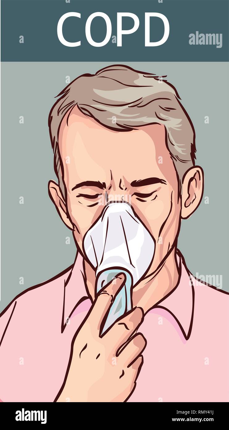 La maladie pulmonaire obstructive chronique (MPOC) Illustration de Vecteur