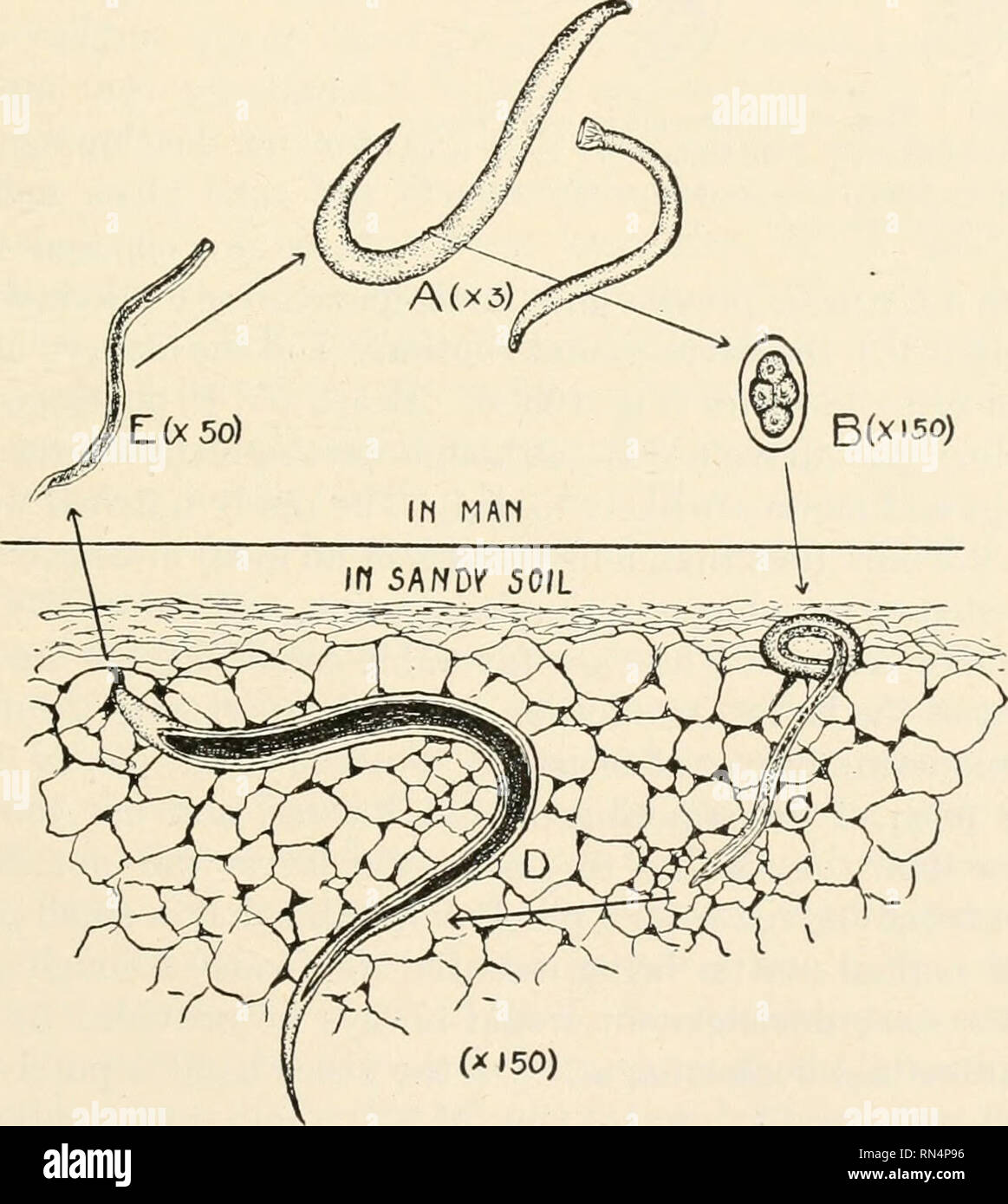 ankylostomiase