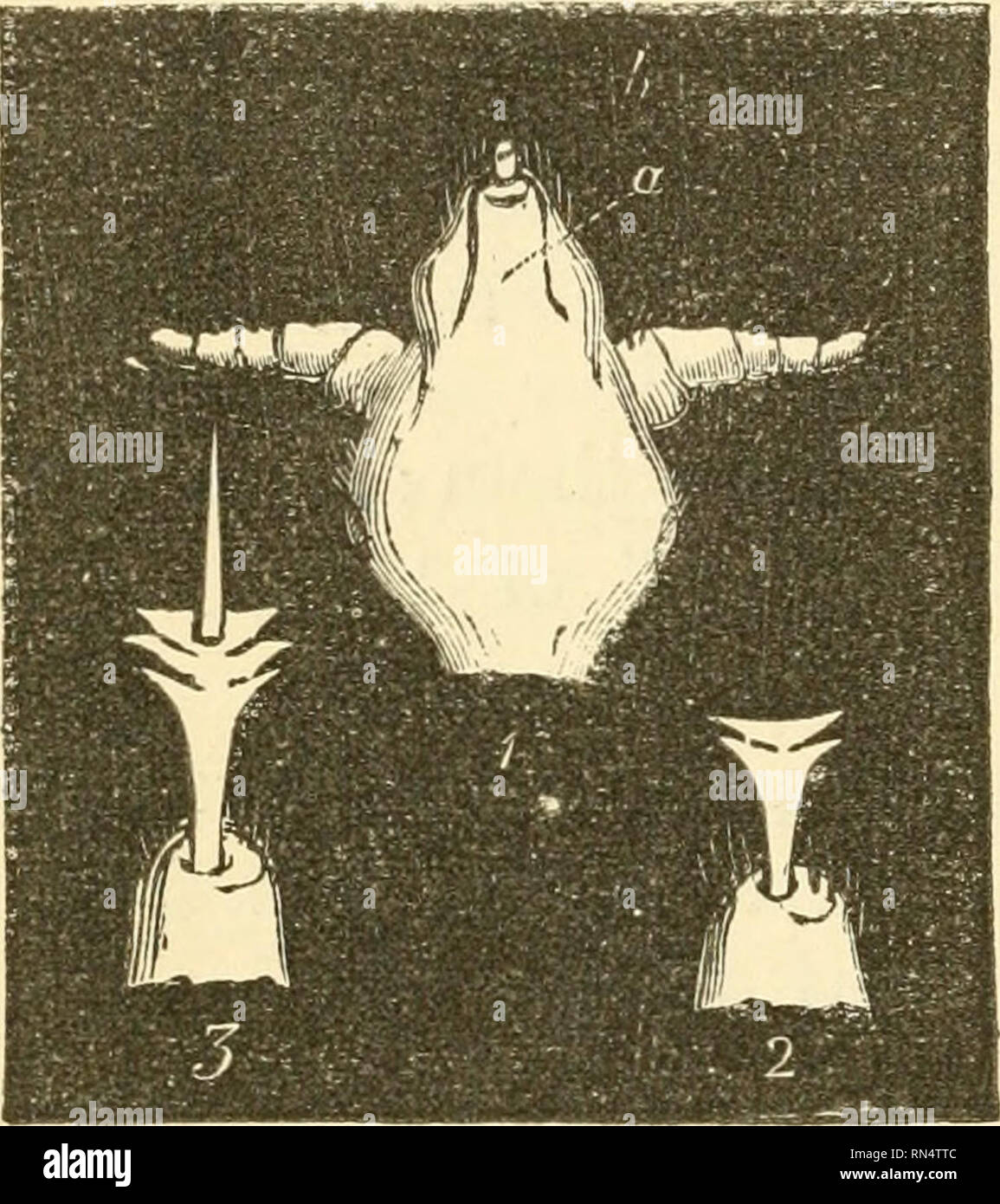 . Des parasites animaux et messmates. Les parasites. ANIMAL 126 PAKASITES ET MESSMATES. constituait une condition pathologique, deux erreurs qui ont maintenant été reconnu, et par lequel la science de la médecine. L'Phthirius pubis est une autre espèce qui n'a été trouvée que sur races blanches, et se fixe en particulier pour les cheveux sur le pubis. Mons. Grimm a publié dans les bulletins de l'Académie de Saint-Pétersbourg, un. Veuillez noter que ces images sont extraites de la page numérisée des images qui peuvent avoir été retouchées numériquement pour plus de lisibilité - coloration et l'aspect de ces illustra Banque D'Images