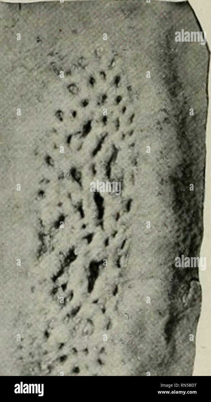 . L'anatomie de l'animal domestique. Anatomie vétérinaire. 422 SYSTÈME DIGESTIF DU CHEVAL tissus lymphoïdes se manifeste sous la forme d'NoduH IjTnphatici (nodules distincts), qui sont soit dispersés ou en groupes. ^ au premier cas, ils sont appelés nodules solitaires (Nochdi lymphatici faisceau solitaire), dans le second des nodules ou des agrégés de Peyer (Noduli lTnphatici aggregati). Les nodules sont ahout solitaire de la taille d'une semence de mil ou un petit grain de sagou. Les patches sont situées surtout le long de la surface à l'opposé de la pièce jointe et mésentériques commencer environ trois ou quatre pieds du pylore. Banque D'Images