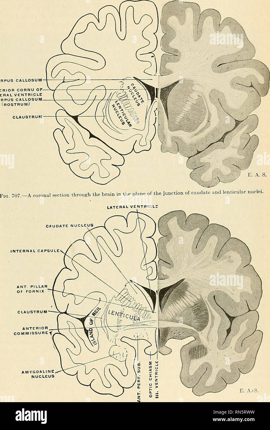 . Anatomie, descriptif et appliquée. L'anatomie. Les hémisphères cérébraux 945 gris le tissus de la substance perforée antérieure (Fig. 685). Il s'agit d'une arc olfactif interne par opposition à l'epicallosal ou l'arc, représenté par l'indusie atrophiés et ses stries longitudinales. Ventricule LATÉRAL CORPUS (CALLOSUNl Tribune). Fig. 708.-une section coronale du cerveau dans l'avion de la commissure antérieure. Le septum Lucidum septum {pelhwidum).-ce qu'on appelle le reallv septum lucidum est constitué de deux hemisepta ou lamina disposé verticalement. Entre eux une étroite hes, espace fermé, Banque D'Images