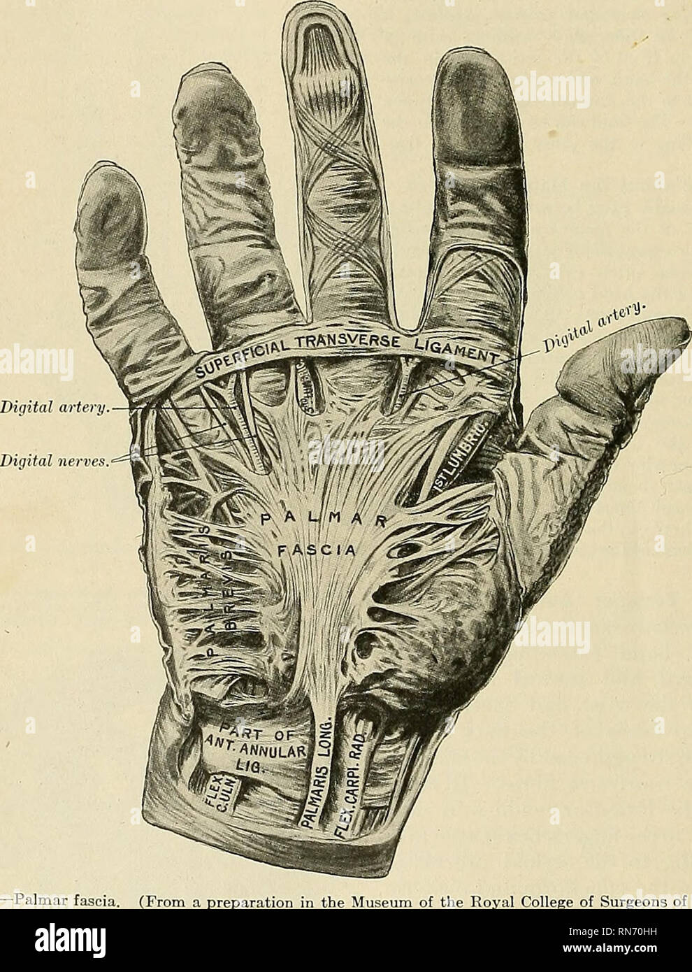 . Anatomie, descriptif et appliquée. L'anatomie. Le MVSCLES FASCIJE 488 et brevior. (3) Vers le milieu de la face postérieure du radius, pour les dix- don de l'appareil extenseur de l'orteil abducteur du pouce. (4) à l'intérieur de ce dernier, pour les tendons de l'extenseur de l'extensor digitorum communis et extensor indicis* (5) oppo- site de l'intervalle entre le radius et cubitus, pour l'appareil extenseur digiti minimi. (6) Usinage de l'arrière de l'ulna, pour le tendon de l'extensor carpi ulnaris. La synoviale qui tapissent ces couches sont généralement très vaste, allant de au-dessus du ligament annulaire vers le bas sur la Banque D'Images