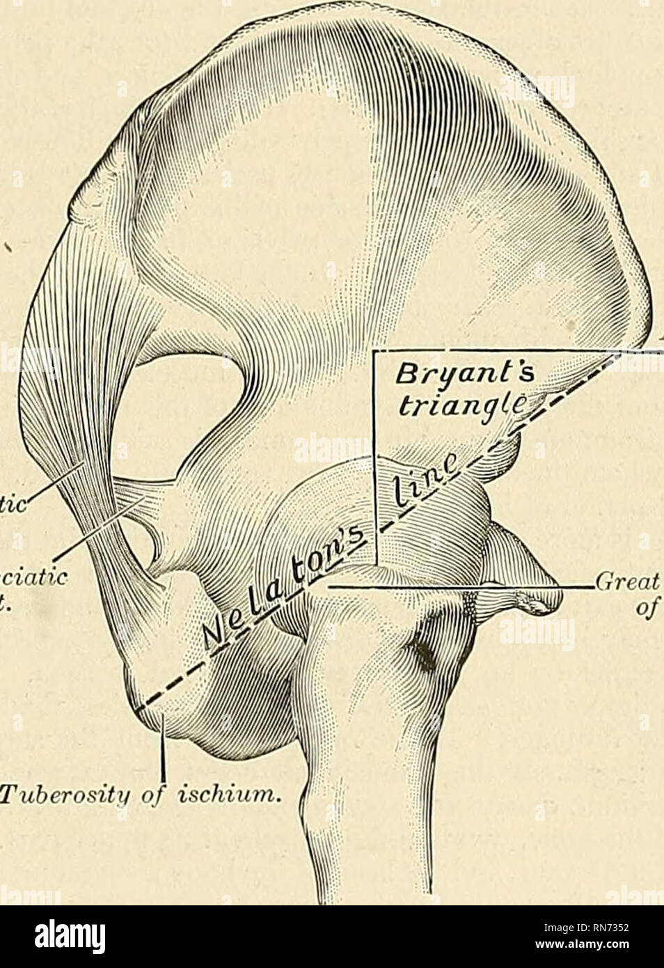 . Anatomie, descriptif et appliquée. L'anatomie. La hanche-fémoral ligament et mixte 329 l'pubofemoral ; rotation vers l'extérieur de la bande, par la bande externe du ligament iliofemoral ; et la rotation vers l'intérieur, par le isehiocapsular ligament et la poupe de la cap- sule. Les muscles qui tordez le fémur sur le bassin sont le psoas, Iliacus, rectus femoris, Sartorius, Pectineus, moyen adducteur et brevis, et la partie antérieure des fibres le gluteus medius et minimus. L'extension est principalement effectuée par le grand fessier, assistée par le cham- string les muscles. La cuisse est atlducted par l'Adductores magnus, lon Banque D'Images