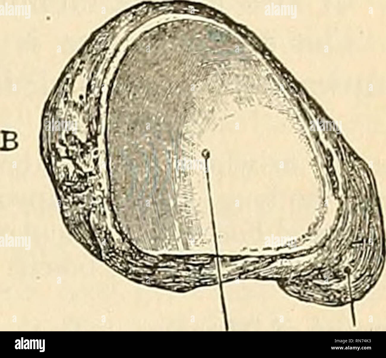 . Anatomie, descriptif et appliquée. L'anatomie. Fig. 197 -Le scaphoïde gauche pour voir l'éternelle de tubercule d'astragale. B. postero-vue intérieure. Pour ForZnd pour 1er métatarse métatarse la mi-cuneiform de déterminer à qui appartient l'os du pied, tenez-le" avec la surface articulaire concave en arrière- ward, et la surface dorsale convexe vers le haut ; la surface externe-i. e., la surface en face de l'bacille-pointe vers le côté où l'os appartient. Articulations.-avec quatre os-astragalus et trois tablettes cunéiformes ; parfois aussi avec le cuboïde. Fixation des muscles.-Une partie de l'posticus tibialis. Banque D'Images