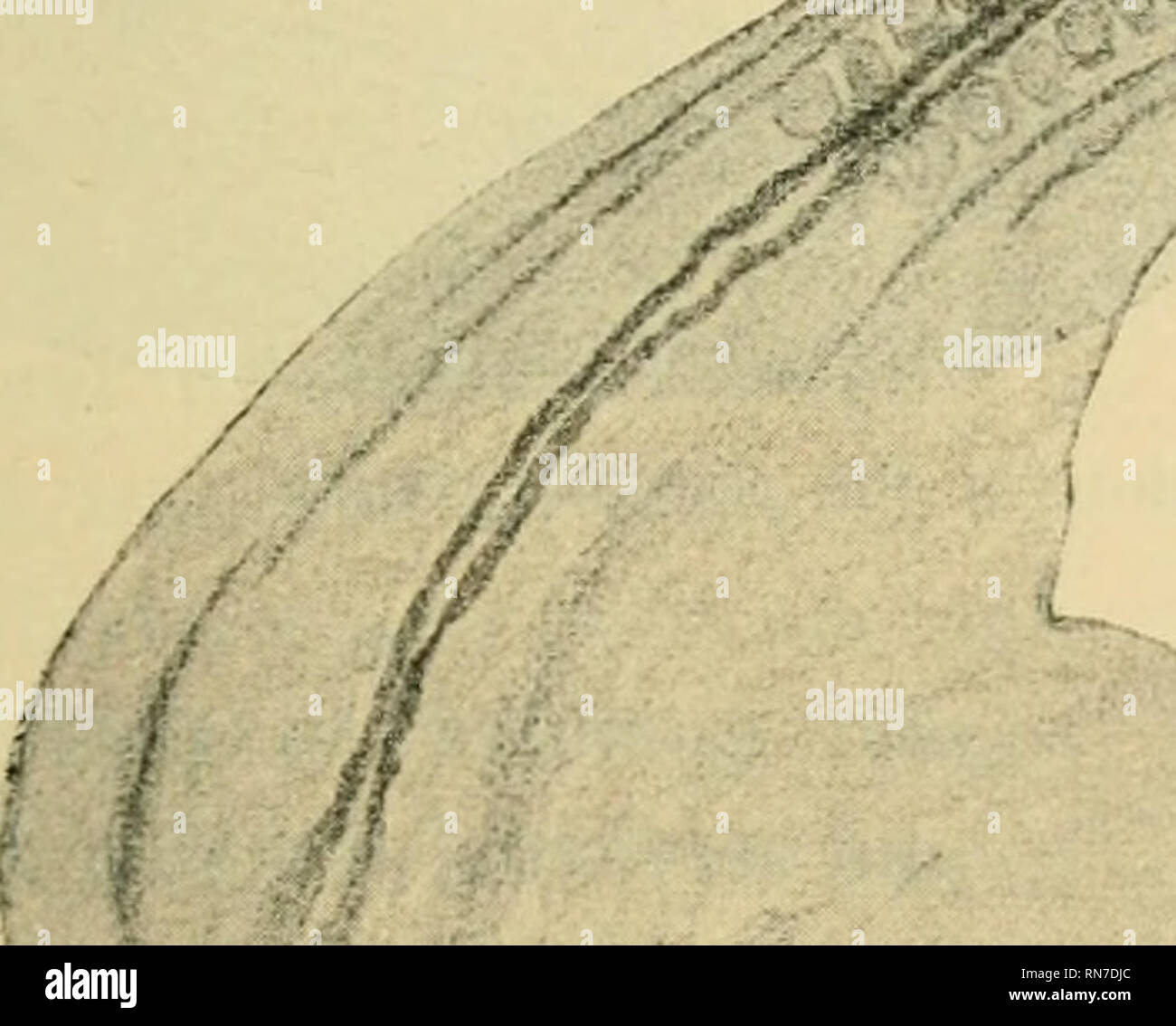 . Anatomischer Anzeiger. L'anatomie, l'Anatomie Comparée ;, comparatif. 489 Dareste croyait que le cœur ont augmenté très rapidement et de plus en plus assez grande dis- placé la tête, mais Kaestner ne conçoit pas ce compte tenu de ce qui précède. Omphalocephalic Dareste décrite dans une chambre double séparée avec monster cous, mais un chef commun. Grundmann61 et Wucker6'2 décrire dans omphalocephalia double poussins de cinq jours d'incubation. Tout à fait récemment Mam- kowsky63 décrit un monstre qui ressemble étroitement à omphalocephalia, ce qui représente le deuxième qui était venu sous son avis. r. Veuillez noter que ces images sont Banque D'Images