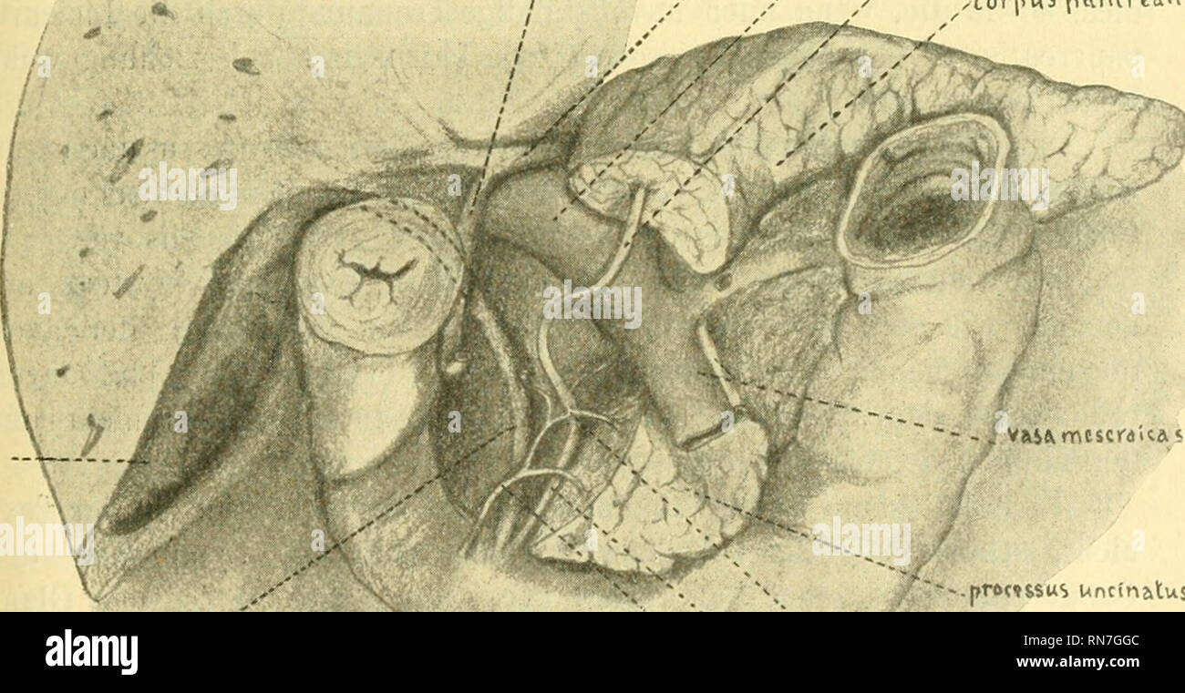 . Anatomischer Anzeiger. L'anatomie, l'Anatomie Comparée ;, comparatif. 419 créez wächst vor der Pfortader Einraündungsstelle, oberhalb der der Venae meseraicae und der Wurzel der Art. meseraica supérieur (Fig.), Magen hinter dem nach links aufwärts zur Alltek, während das obere, dorsale, kleine Pankreas, rechts neben der Pfortader zuerst nach oben zu gegen den pylore, bis die unter der Teilungsstelle Vena portae, wächst und dann des Wachstumswiderstandes infolge der gerade Leber nach abwärts über das Ende des Körpers der großen Bauchspeichel drüse-. Unter diesem biegt es hakenförmig um nach links Banque D'Images