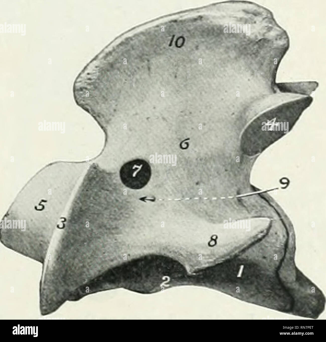 . L'anatomie de l'animal domestique. Anatomie vétérinaire. Fig. 122.-Atlas de boeuf ; vue dorsale. 1, 2, ; tubercule dorsal foramen intervertébral ; 3, 4 : foramen ;, aile ; 5, 5, surfaces articulaires postérieures ; 6, passage central (surface d'antres de l'axe). Fig. 123.-Axe du boeuf ; Vue latérale, I, ; 2, 3 ; rachis ventrale, apophyse antérieure ; 4, 5 ; processus articulaire postérieure de l'art ; 6, 7 ; arch, foramen intervertébral ; 8, produc- tion transversale ; 9 foramen transversarium, et cacalis {trana- je ligne pointillée) ; 10, apophyse épineuse.. Veuillez noter que ces images sont extraites de la page numérisée des images qui ma Banque D'Images