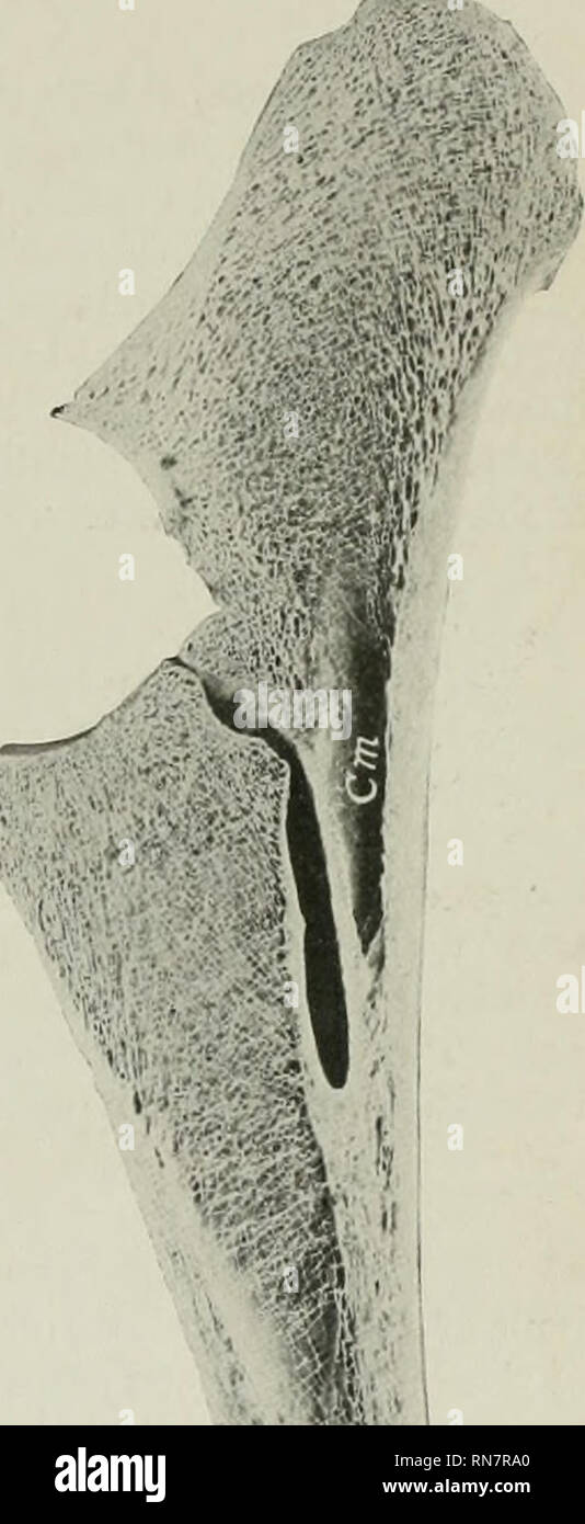 . L'anatomie de l'animal domestique. Anatomie vétérinaire. FiG. 69.-di( en ra i ET CUBITUS Ho Fin Fig. VO.- -Section sagittale ' rayon et LSN'j 1, 2, 3, 4, aspects qui définissent avec radial, cubital, intermédiaires, et os carpiens accessoire respectivement ; 5, de rainure de tendon exten- dors radial deuxième ; 6, groove pour tendon de l'extenseur digital commun ; 7 tubérosité, pour raccordement de ligament médial du carpe. Cm, cavité médullaire de la lsn tremity fusibles avant la naissance avec le rayon. L'olécrâne unit avec le reste de l'os à environ trois ans et demi. Une cavité médullaire semble Banque D'Images