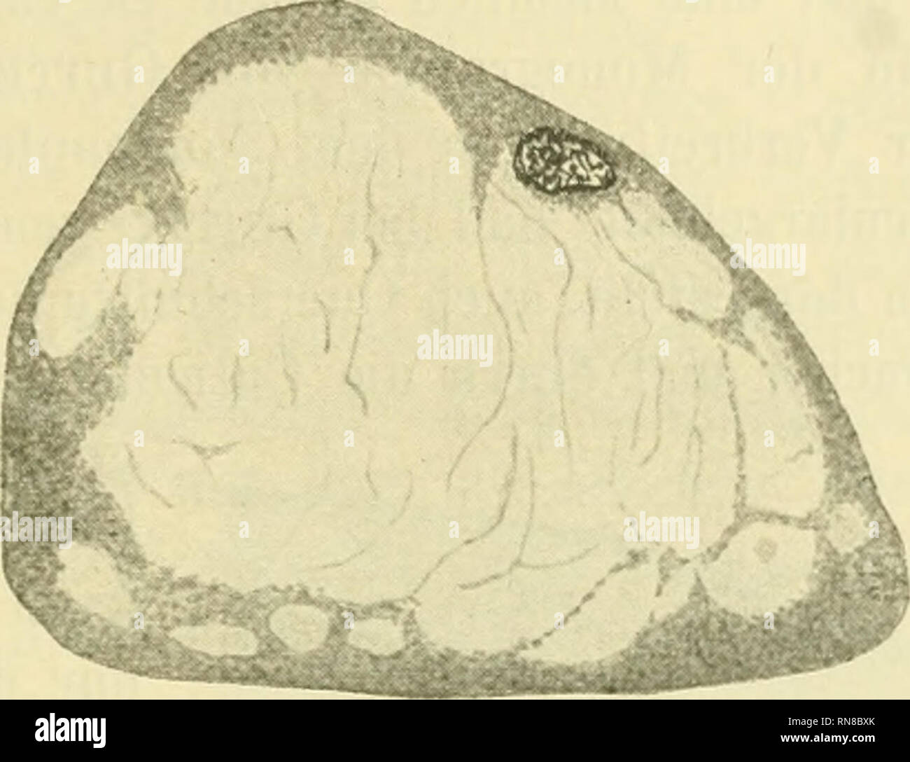 . Anatomischer Anzeiger. L'anatomie, l'Anatomie Comparée ;, comparatif. EntAvickelung Sekretes 141 meurent des beginnt bei den Schleimzellen Lepadcgaster von immer in der Nähe des Kernes. Es bilden sich da und kleinere 1907-1988, die größere Vakuolen schließlich miteinander verschmelzen, dass daraus ein Bild donc resultiert, wie es die Fig. 9 darstellt. Eine noch mehr Sekret enthaltende Schleimzelle zeigt unsere Fig. 10. Wir sehen an derselben, wie durch das das Sekret Proto-. Fig. 9. Fig. 10. Ecran plasma mit dem Zellkern zur Seite gedrückt wird. Die Grenze des proto- plasma gegen das ist zu Sekret in dies Banque D'Images