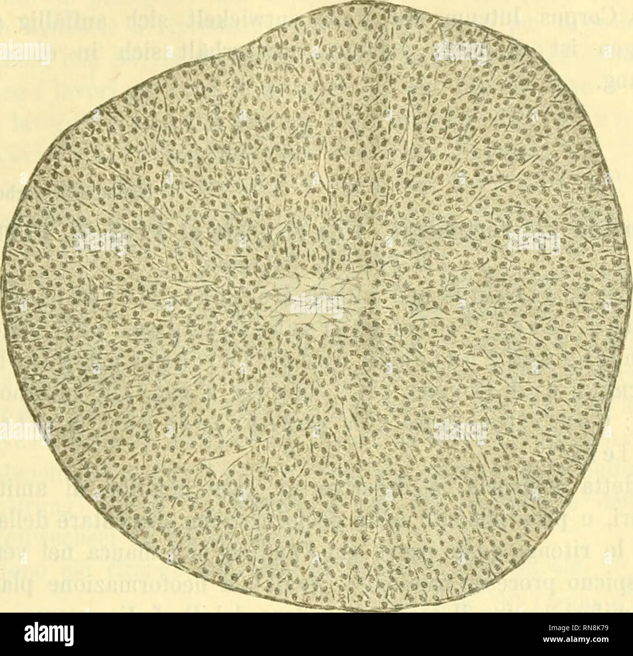 . Anatomischer Anzeiger. L'anatomie, l'Anatomie Comparée ;, comparatif. 489 Fig. 7.. bilden. Im Centrum des Gebildes findet man une Stelle des ehemaligen Flüssigkeitsergusses einen kleinen, nur gallertigen Bindegewebskern oft minimalen. Wenn eine größere Follikelsprung Blutung haus stattgefunden hat, pour Erguß erleidet der gleichen die Veränderungen, wie jeder patho- logischer Weise erfolgte im tierischen Körper. Der Blutfarbstoff krystallisirt ausgelaugt und wird oft als dans Hämatoidin Epithelzellen oder zwischen den wieder aus. Der Rest des Gerinnsels schließHch organizirt wird und bildet gleichfa Banque D'Images