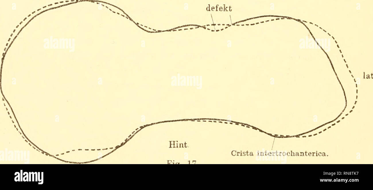 . Anatomische Hefte. Indice. 1 / intertrochanterica Crista Fig. 16. Transversalschnitt Schenkelhals 1 durch den Neandertal. , 92 K Australier Vorn. med. defekt. Crista intertrochanterica. Fig. 17. Transversalschnitt Schenkelhals haus Neanderthaler durch den 1. und espion. 1 . Gehen wir nun zur Uetrachtung proximalen- fémur des teiles über, donc zunächst die ich möchte die drei erwähnen.. Veuillez noter que ces images sont extraites de la page numérisée des images qui peuvent avoir été retouchées numériquement pour plus de lisibilité - coloration et l'aspect de ces illustrations ne peut pas parfaitement ressembler à l'origine Banque D'Images