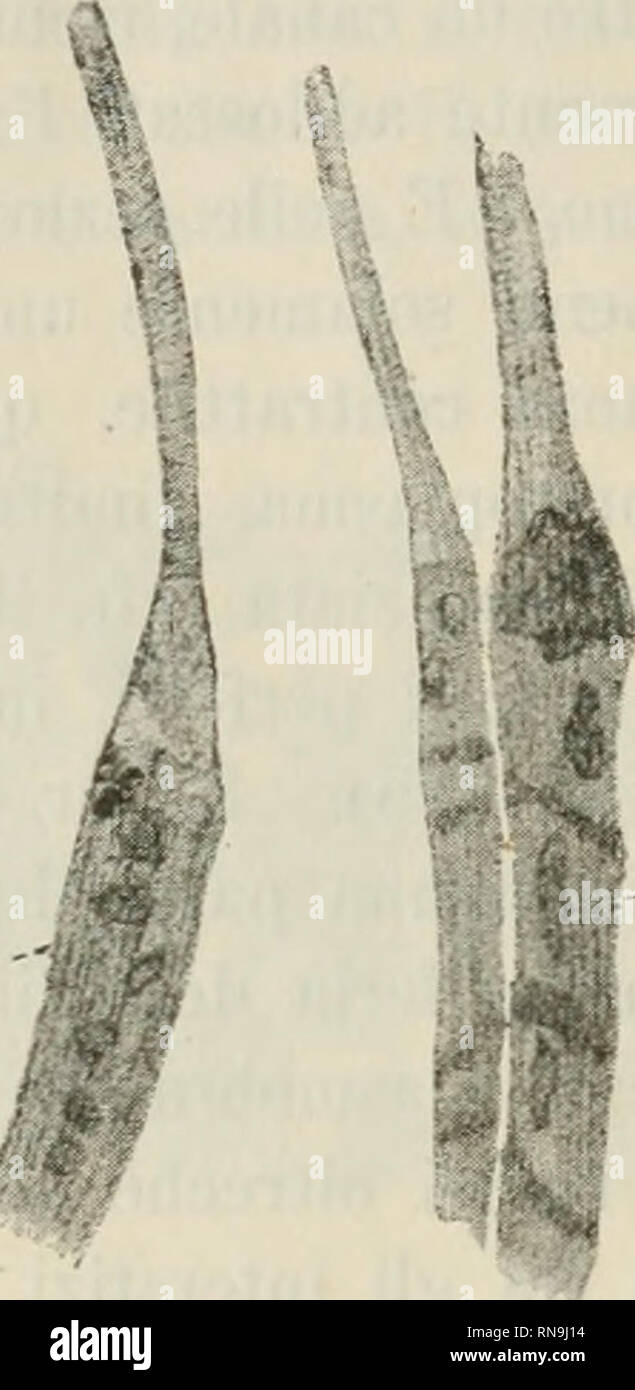 . Anatomischer Anzeiger. L'anatomie, l'Anatomie Comparée ;, comparatif. 746 dal trovate Felix iiei muscoli deir embrione umano e da lui fenomeui inter- venir prélat di disfacimento delle fibre. La preseoza yerciö Bastera citare ispessimeuti iutercalari ui questi- tudiuale striatura lougi di che, dans inauca uraano quelli dell'embrione. (Fi^. 3.) Fig. 3. Fig. 4,. / ./ ^ Spiegaisioue P ?miss della Fig. 3. Due pezzi di ßbra uiu&amp;colare iüolati Turpedo einbrioue uu da di lungo oceUata 7 cm. Les iugrosäameuti iutercalari ätati disegiiati bouu ii da uua sula colla parte terminazione assotti iieUa parte Banque D'Images