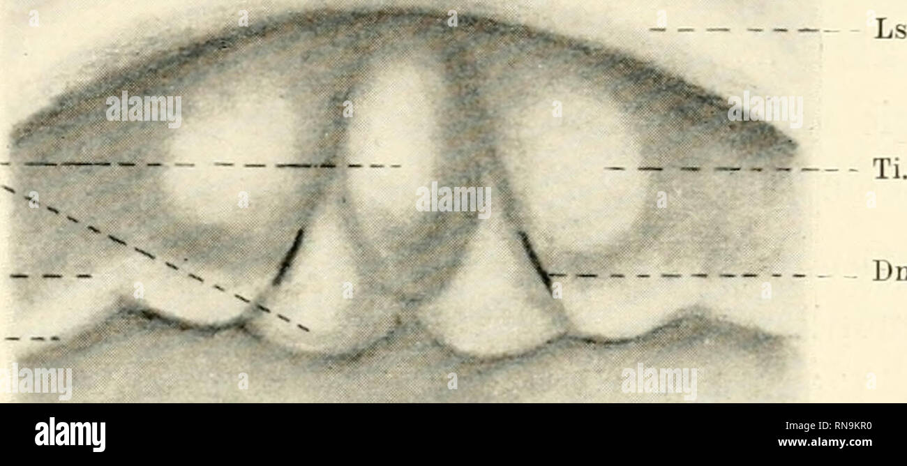 . Anatomische Hefte. Die Entwickelung des Gaumens sekundären einiger Säugetiere etc. 135 steckiiadelkopfgruss sind nur. Eiiizehieu Rundparticii Stubaitalstrasse der Die sind wie immer, deutlich, abgegrenzt. ^steht der Seitenrand Ix- und Flügel aus dem liaiidknolen ; der obere Rand ist von dem dahinter gelegenen détachées sehr scharf abgesetzt, und der untere hat sich mit seinem hinteren Zipfel weit nach vorn zurückgezogen. Mantel der teil des Vordergesichtes vollstcändig ist nunmehr vite Haaranlagen niil versehen ; nur das (ieljiet der p.. Dnp. Gl = Fig. 48. Vergrösserte Papillengegend sekundä Ansicht der des Banque D'Images