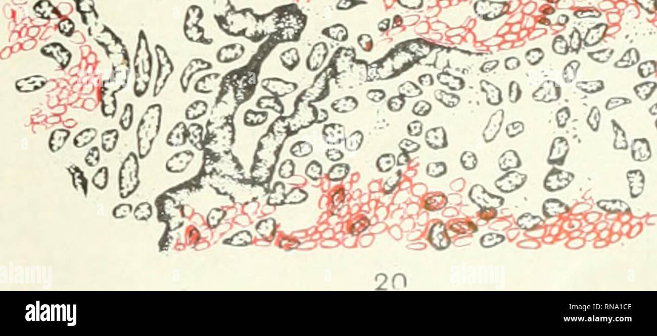 . Le dossier anatomique. Anatomie Anatomie ;. r |/ i "0". Fig. 17 à partir de la rate accessoire pancréatique un lapin. Liicida caméra Fig. 18 L'article d'un ijancreatic la rate d'un lapin. X 410. Fig. 19 hemal pigmentées ( ?) noeud. X 515. Fig. 20 Peinture nœud mixte. X 515. X 79. 513. Veuillez noter que ces images sont extraites de la page numérisée des images qui peuvent avoir été retouchées numériquement pour plus de lisibilité - coloration et l'aspect de ces illustrations ne peut pas parfaitement ressembler à l'œuvre originale.. Bardeen, Charles Russell, 1871-1935, ed ; Boyden, Edward A. (Edward Allen), 1886-1976 ; Bremer, John Lew Banque D'Images