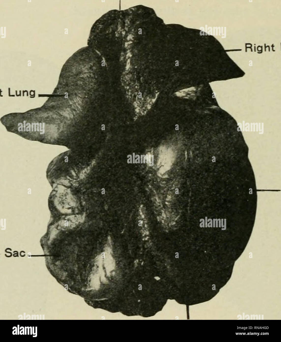 . Le dossier anatomique. Anatomie Anatomie ;. Le Eecord 358 anatomique. Pour le bénéfice de ceux qui pourraient être intéressés à partir d'un point de vue obstétrical, je donne l'historique de l'affaire : la mère, femme au foyer ; general ph3'sical ; état, bon nombre de preg- nancies, deux ; travail a commencé, le 24 octobre, 1907 ; première visite, 1,15 m.^ p, même jour ; présentation, vertex ; position, l'occiput ; antérieure gauche de l'utérus, repris ; OS utérin, entièrement dilaté ; cœur fœtal, n'a pas pu être entendu ; pouls de mère avant, 86 ; après, 76 ; température avant, 98,8 ; 99,2°, après rupture des membranes, 9 ; a. m., le 24 octobre, 1 Banque D'Images