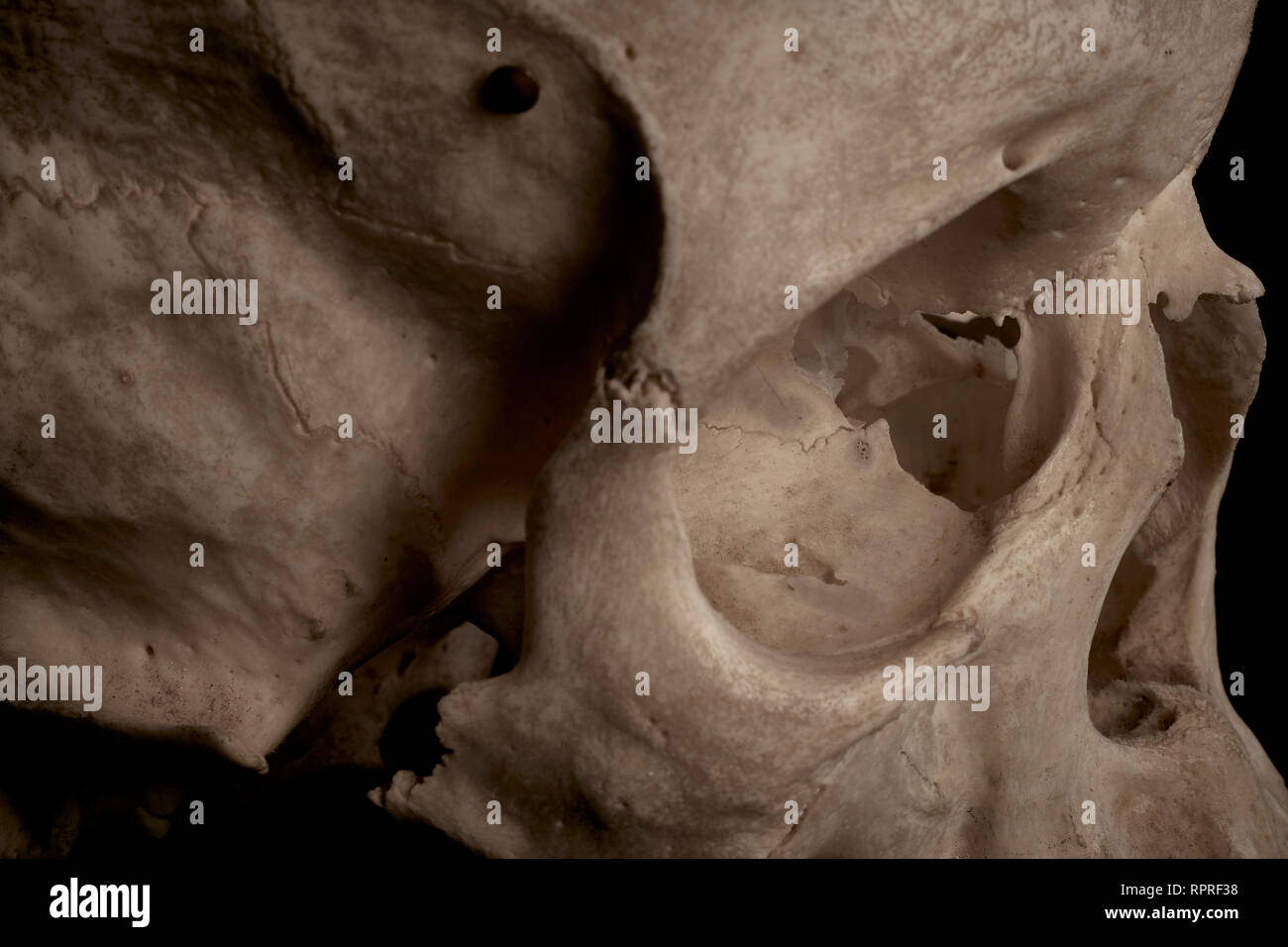 Extreme close up du côté droit d'un crâne humain en mettant l'accent sur le globe oculaire. Banque D'Images