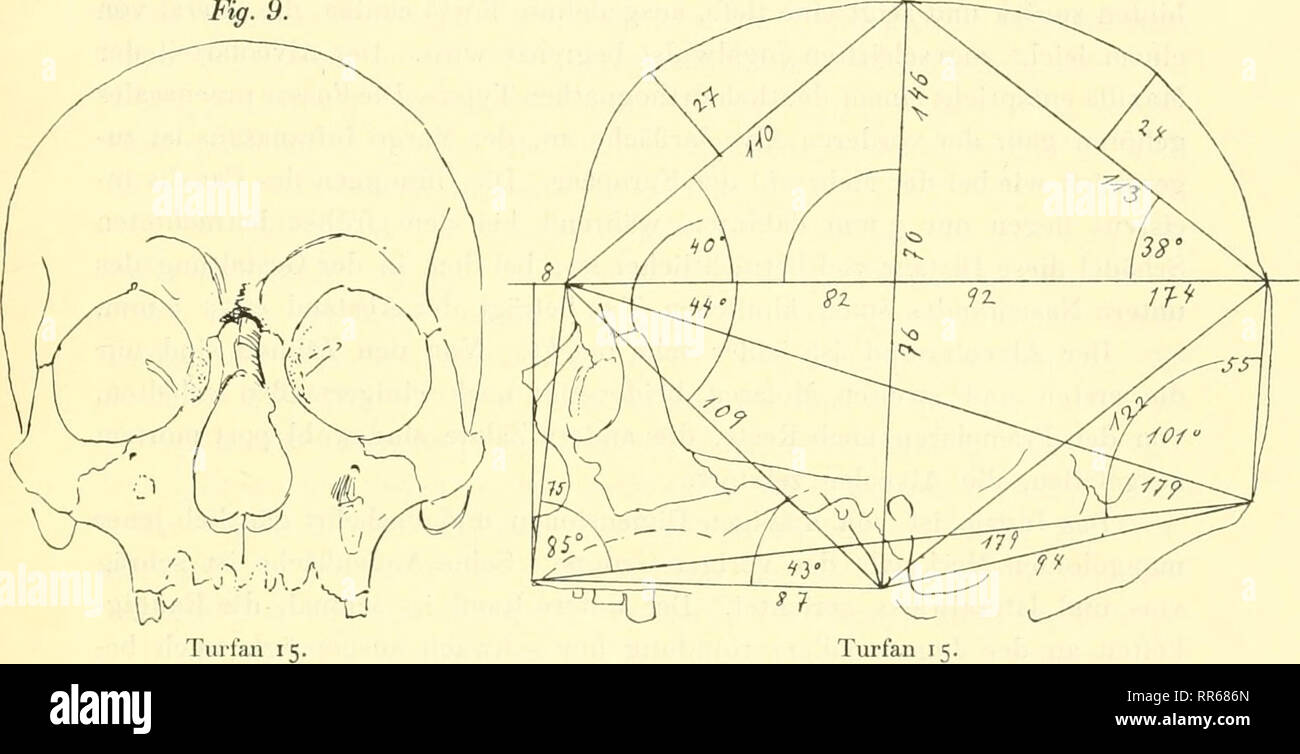 . Abhandlungen der Königlich Preussischen Akademie der Wissenschaften. La science. Morphologische Studien zur Rassendiagnostik Turfanschädel der. 2H die Arcus superciliares, Das Breite hier ungefähr 20 mm beträgt. Mediankurve Glabellarerhebung läßt die eine im ganzen die am weitesten erkennen, vorspringender Punkt sicli deutlich bestimmen lässt. Dieser Gla- bellarpunkt steht vom Nasion 7 mm ab. Er wird von den seitlichen sten- Wül überragt. Oberhalb der glabelle, als tiefster Punkt im supra- sillon orbitalis findet sich das Ophryon en 20 mm Entfernung vom nasion. An der M-Gruppe dieser il pu Banque D'Images