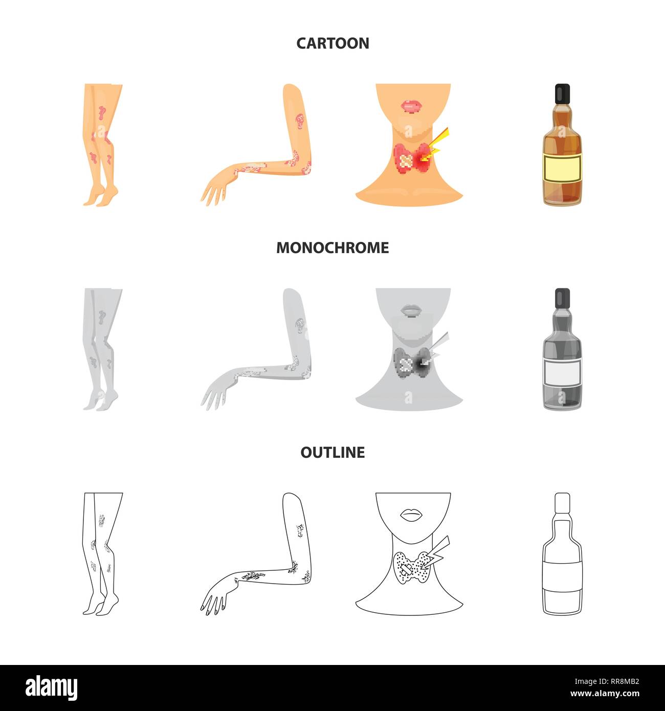 Psoriasis dermatite,corps,endocrinien  système,bouteille,peau,cou,whisky,eczéma,,fessier anatomie,alcool,infection,démangeaisons,verre,malade,chroniques,des,boissons,petit,thyroïde,vodka,stress,traitement,verre,rhum,jambes,glande,dépendance,médical,,la  ...