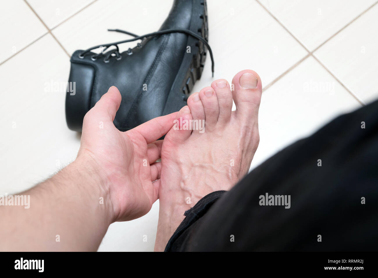 Terrible sanglante ampoule sur pieds humains avec de nouvelles chaussures  en cuir noir autour de la pose. Douloureuse de la peau sanglante humide sur  l'homme pied avec du plâtre. Plaies douloureuses sur