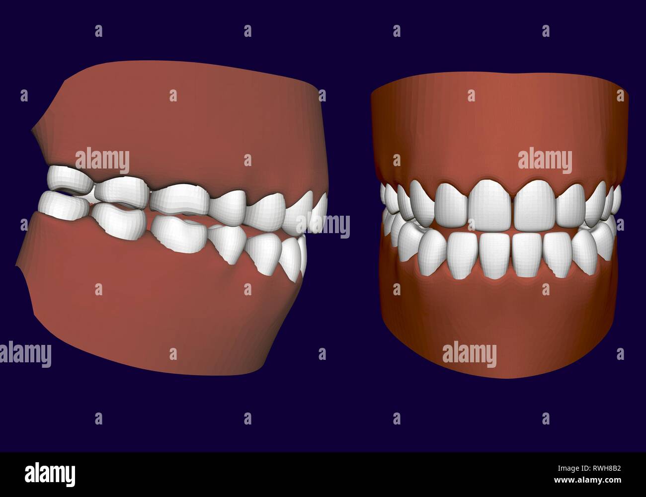 Mâchoire humaine avec les dents. Côté et Vue de face. 3D. Mâchoire isolé sur un fond blanc. Les dents de la santé humaine. Les dents prothétiques. Vector illustration Illustration de Vecteur