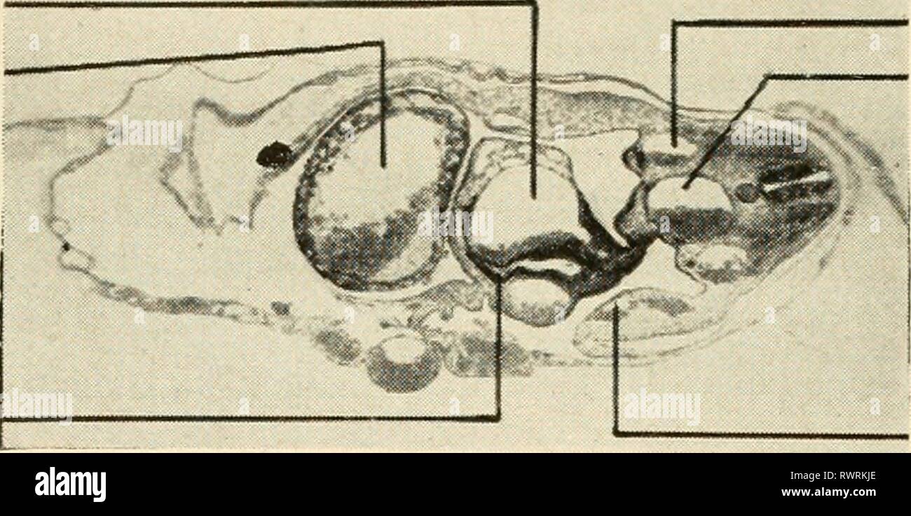 L'embryologie embryologie embryologie (1949) Année : 1949 bart00conduit veineux de la veine cardinale postérieure du ventricule AORTE VEINE ALLANTOÏDIENNE Fig. 151. Le foie. Comme nous l'avons vu dans les chapitres 12 et 13, le foie fait en étroite relation avec le canal d'Arantius. Ce navire se forme par la fusion de la veine vitelline juste en arrière du sinus veineux. Des excroissances de l'endoderme forme autour du canal d'Arantius, qui est entouré de mésenchyme et sup- porté par un mésentère dorsal. Le foie enfin complètement enveloppant le canal d'Arantius. Plus tard, les veines vitelline de perdre leur connexion avec ce bateau Banque D'Images