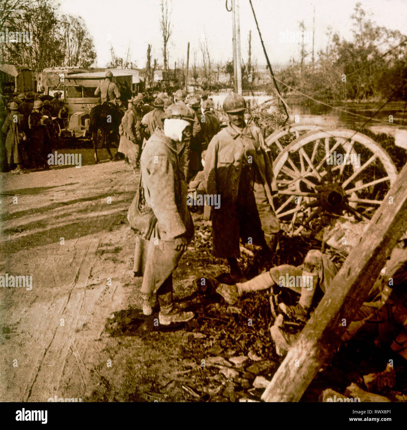 Photographie , blessé de Septembre 25, 1918 dans la Somme Banque D'Images