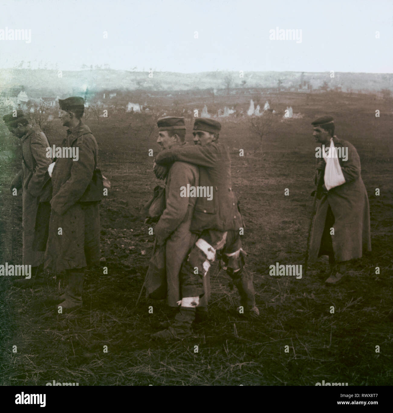 Photographie , blessés et prisonniers allemands dans l' Aisne en 1918 Banque D'Images