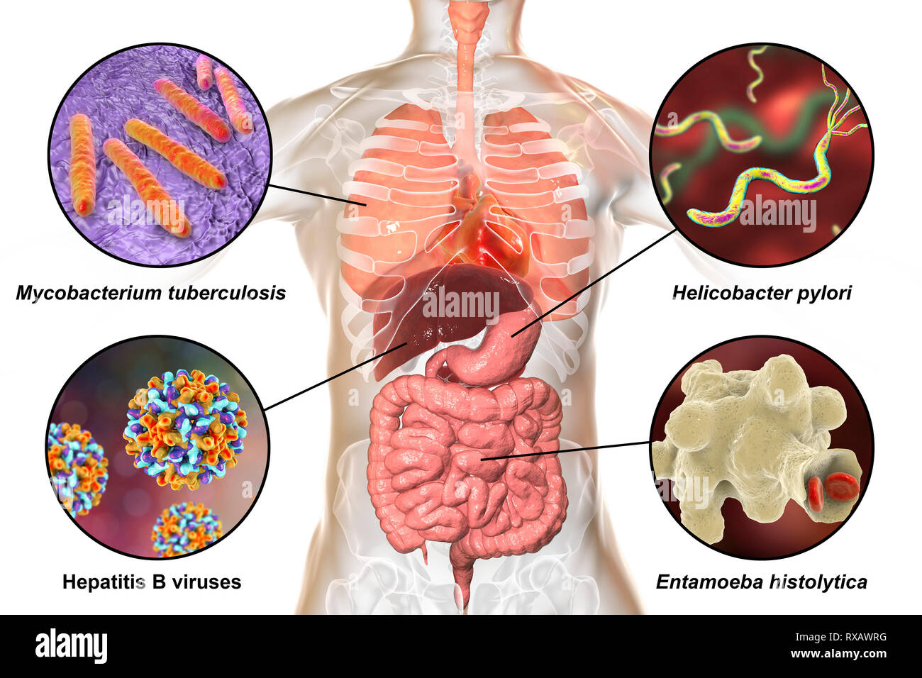 Les bactéries qui causent les infections humaines, illustration Banque D'Images