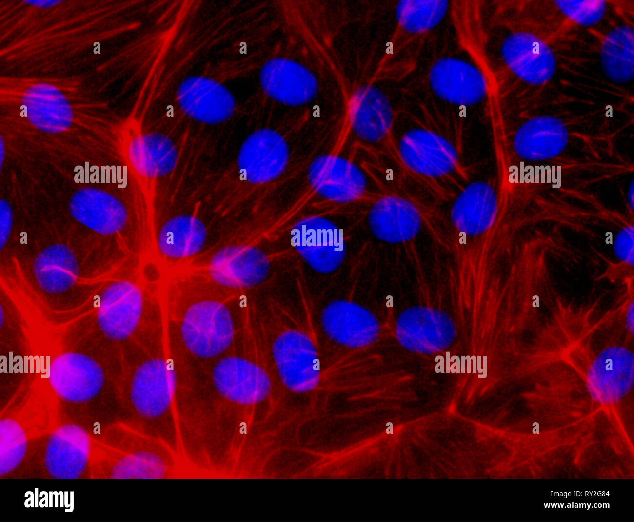 La microscopie confocale en fluorescence des CRISPR knockout générés les cellules. CRISPR (Clustered entrecoupées régulièrement palindromiques court répète) modification génétique Banque D'Images