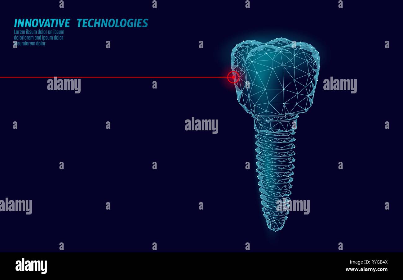 Implant dentaire médecine poly faible concept. Stomatologie dentaire innovation technologie vecteur modèle de page d'illutration Illustration de Vecteur