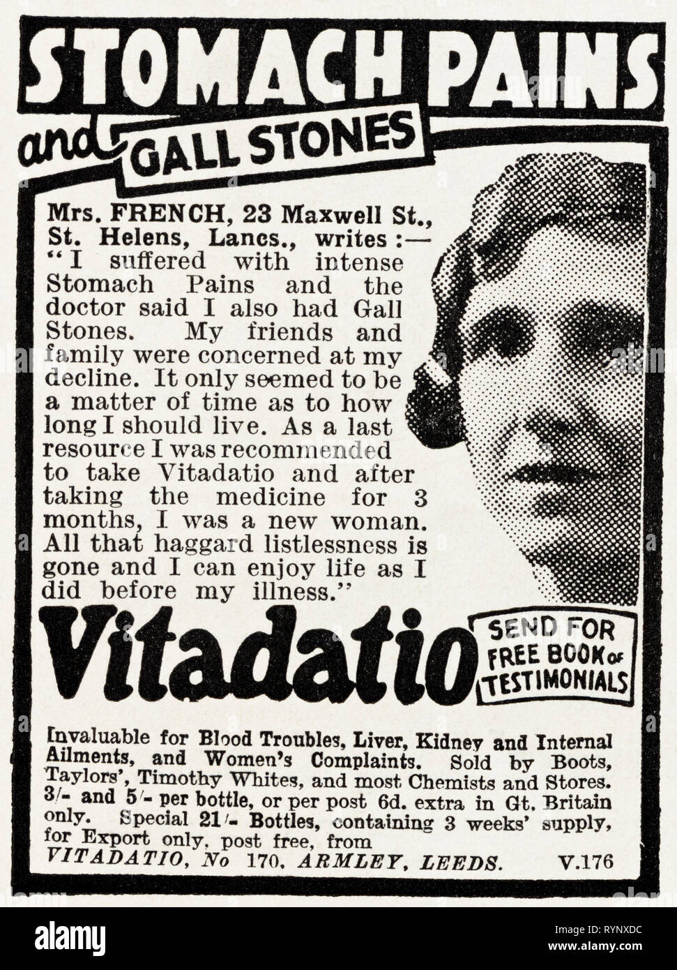 1930 Original vintage ancienne publicité imprimée à partir de 30s magazine anglais Vitadatio la publicité pour des douleurs d'estomac et des calculs biliaires de Armley Leeds England UK vers 1932 Banque D'Images