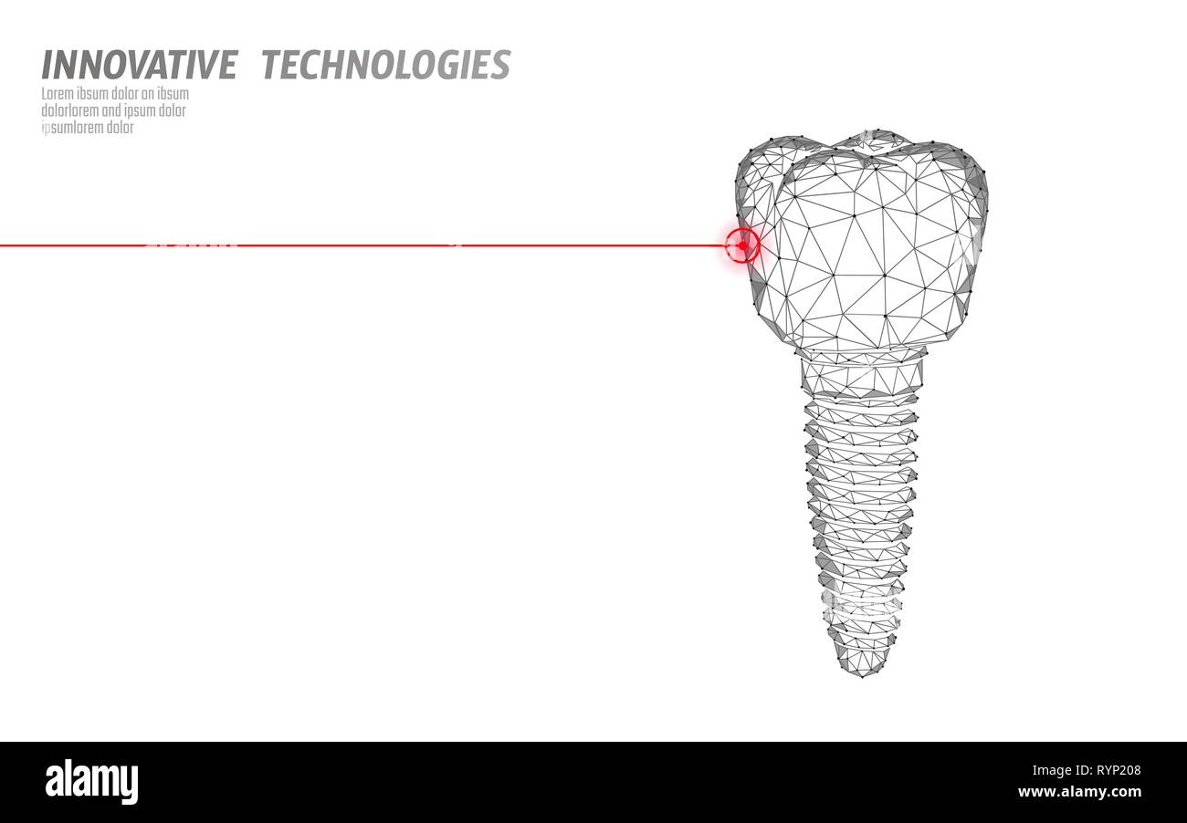 Implant dentaire médecine poly faible concept. Stomatologie dentaire innovation technologie vecteur modèle de page d'illutration Illustration de Vecteur