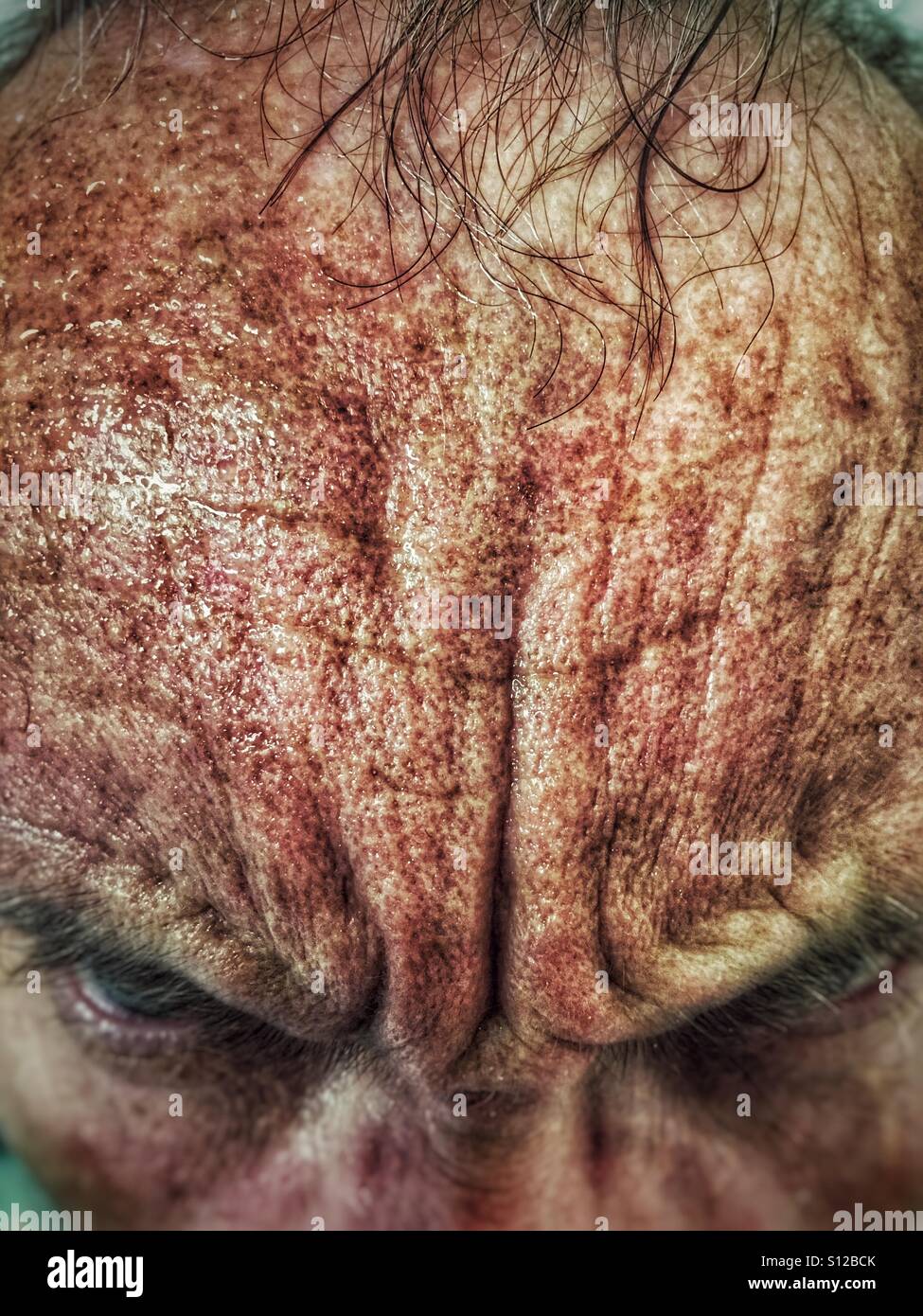 Close up de transpiration du front de l'homme d'âge moyen Banque D'Images