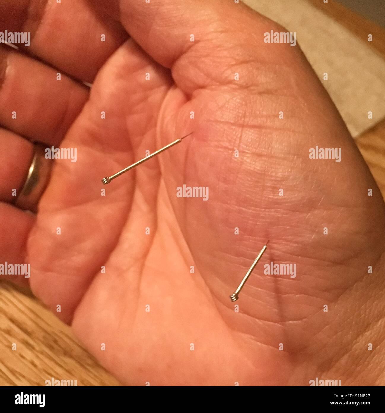 Aiguille d'Acupuncture dans un mans hand Banque D'Images