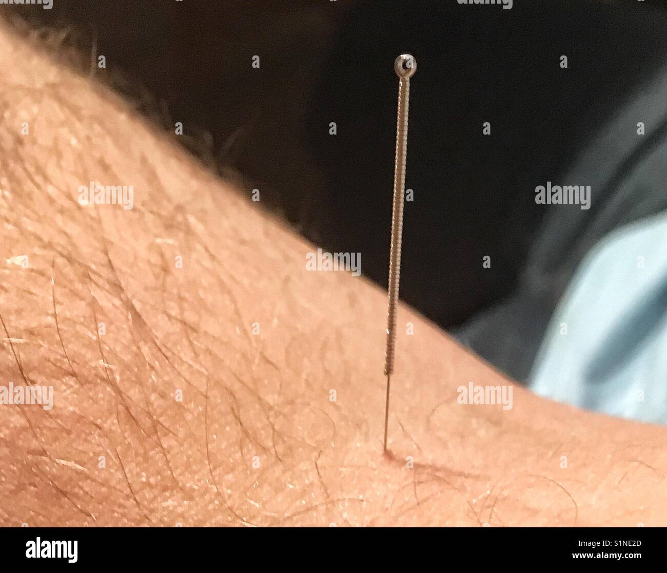Aiguille d'acupuncture dans un bras du Mans Banque D'Images